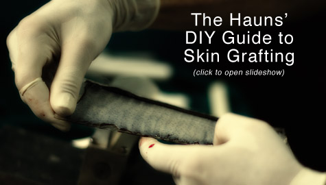 Skin Grafting Slideshow Link