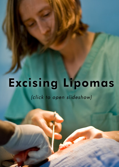 Slideshow Link - Excising Lipomas