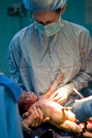 Heidi delivers a newborn via c-section