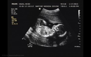 Our baby on Jan 17th (18weeks)
